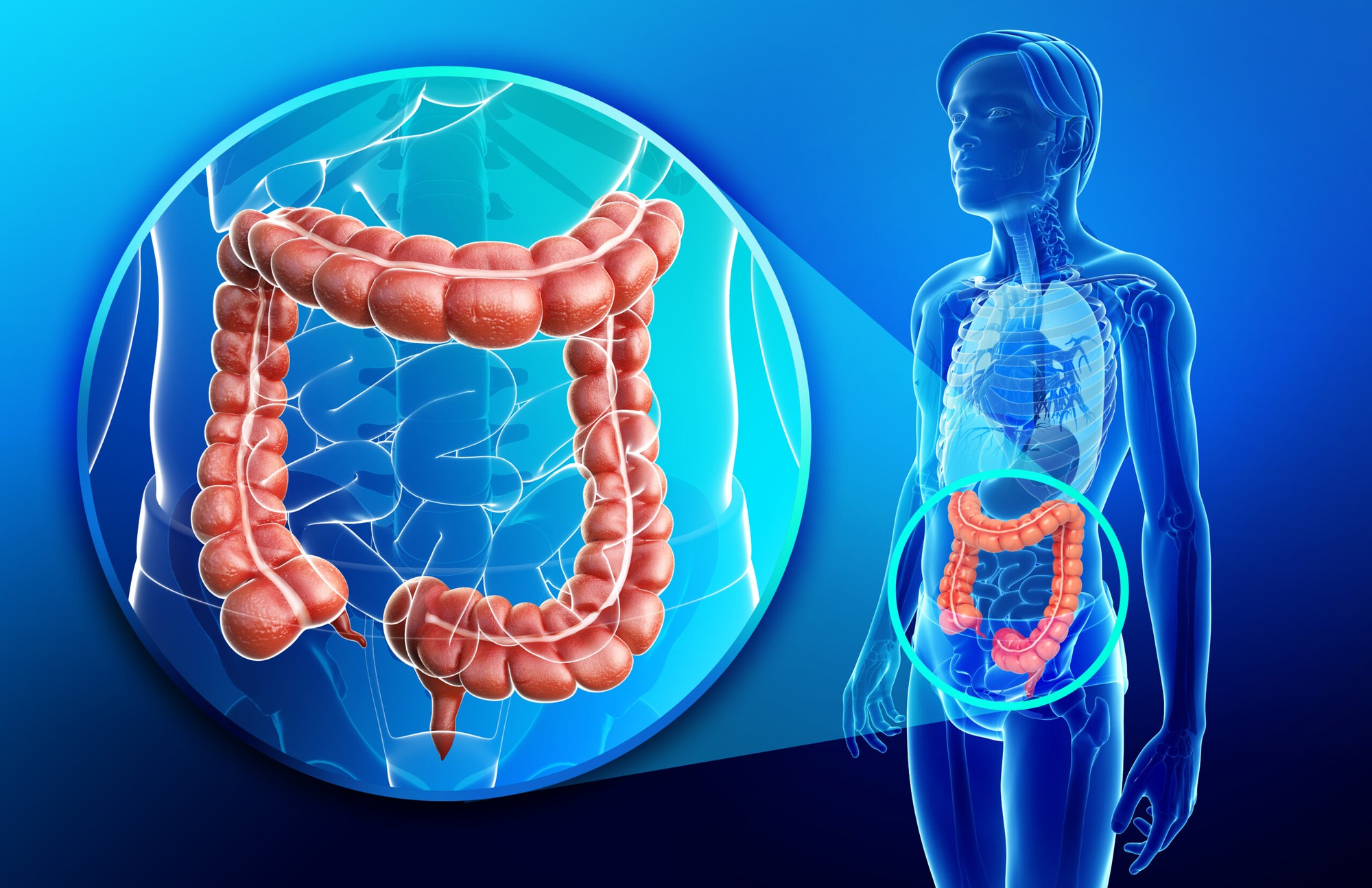 Các Yếu Tố Rủi Ro Mắc Ung Thư Đại Trực Tràng Cần Nhận Diện Đúng