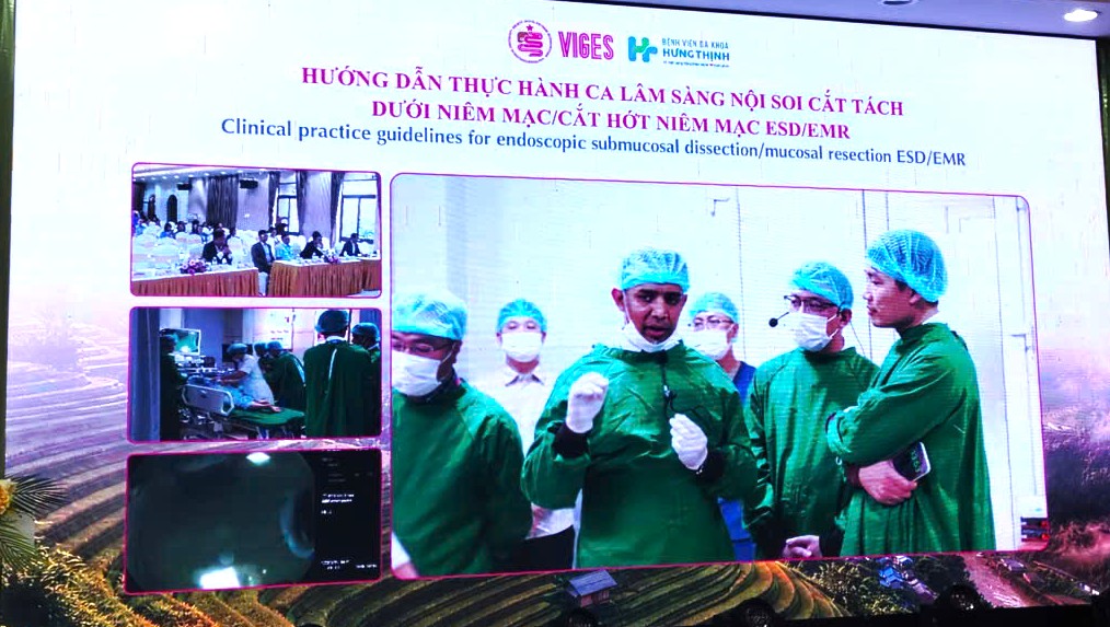 Cải Tiến Kỹ Thuật Nội Soi Tiêu Hóa: Hướng Tới Nâng Cao Chất Lượng Chăm Sóc Sức Khỏe