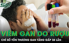 Đáng Sợ: Người Đàn Ông Sống Với Sán Dây Trong Tủy Suốt 12 Năm