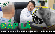 Khám Phá Những Loại Cá Giá Rẻ Đầy Dinh Dưỡng Tại Việt Nam