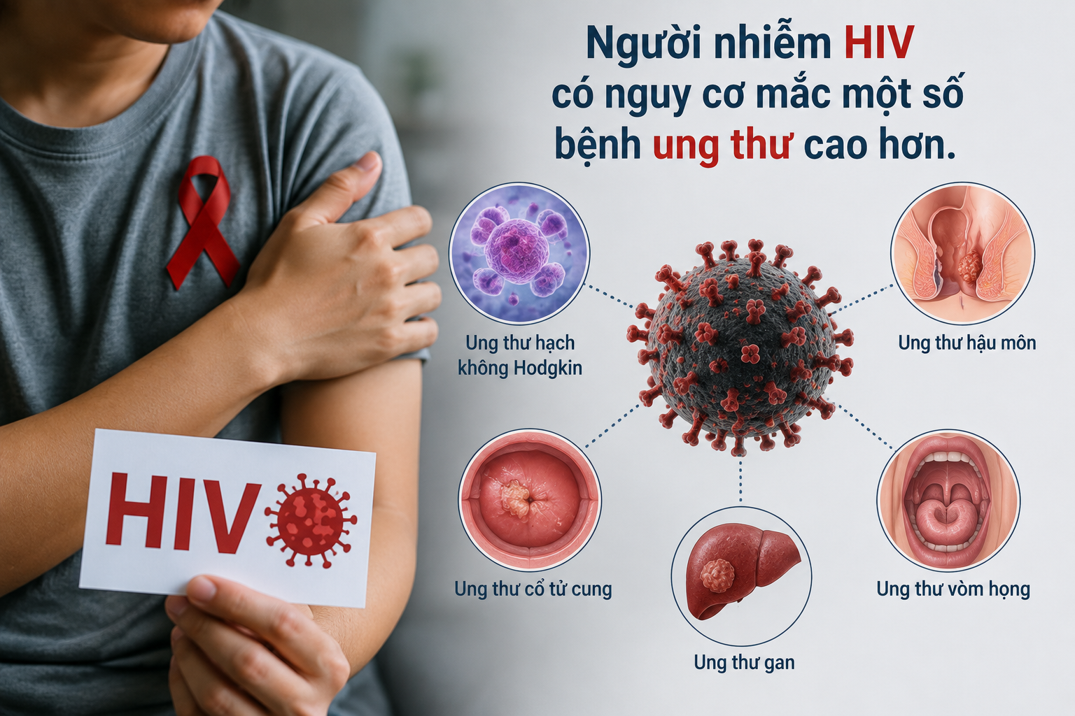Khám Phá Tầm Quan Trọng Của Tầm Soát Ung Thư Đối Với Người Nhiễm HIV - Ảnh 1.