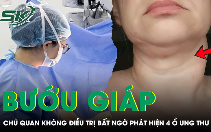 Khối u tuyến giáp