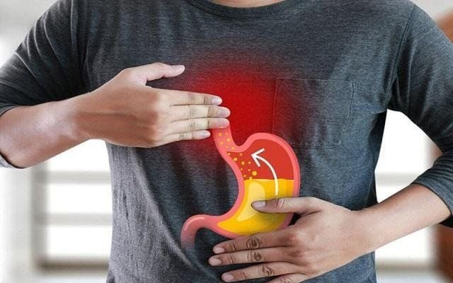 Phát Hiện Sớm Trào Ngược Dạ Dày – Thực Quản và Cách Phòng Ngừa Hiệu Quả