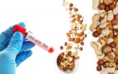 Bệnh viện S.I.S Cần Thơ Nhận Chứng Nhận SILC: Đột Phá Trong Điều Trị Đột Quỵ