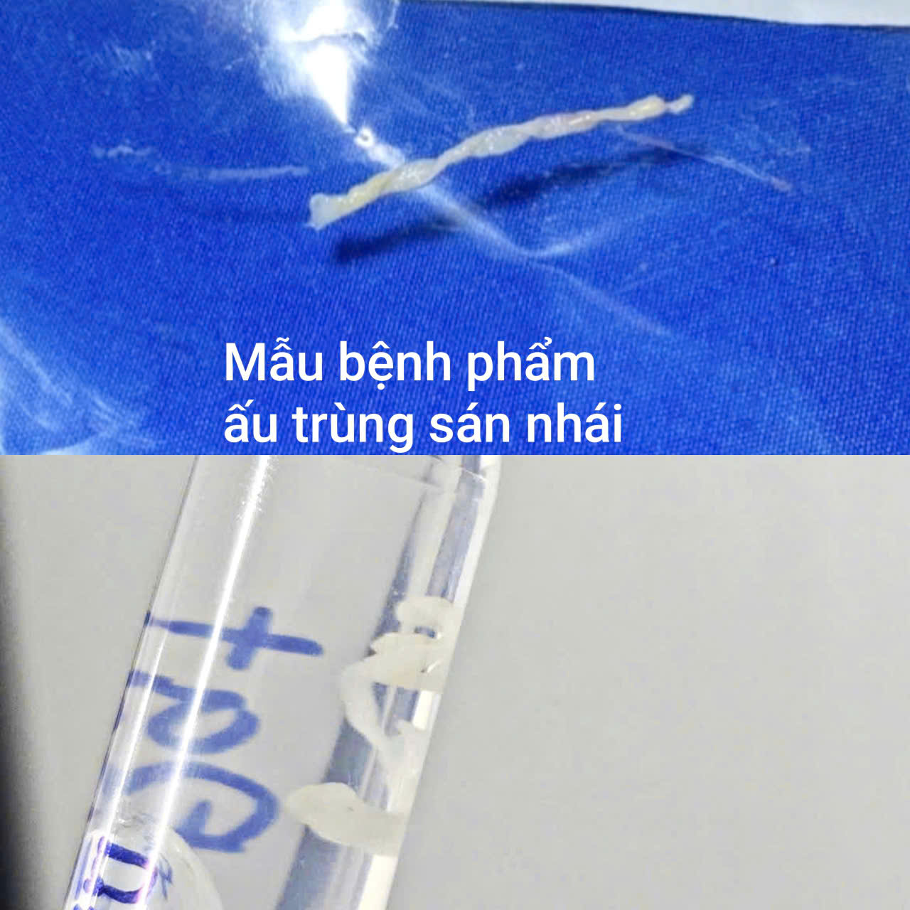 Nguy cơ tiềm ẩn từ nước suối: Câu chuyện cảnh giác- Ảnh 2.