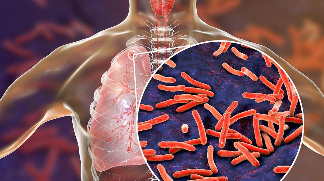 Những Dấu Hiệu Cần Lưu Ý Khi Ho Ra Máu: Khi Nào Cần Nhập Viện Ngay?