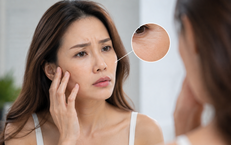 Lựa Chọn Tập Luyện Hiệu Quả Cho Người Trên 50 Tuổi Bị Tăng Acid Uric