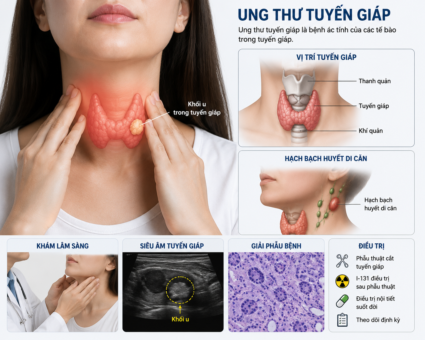 Ai Cần Điều Trị I-131 Sau Phẫu Thuật Ung Thư Tuyến Giáp?