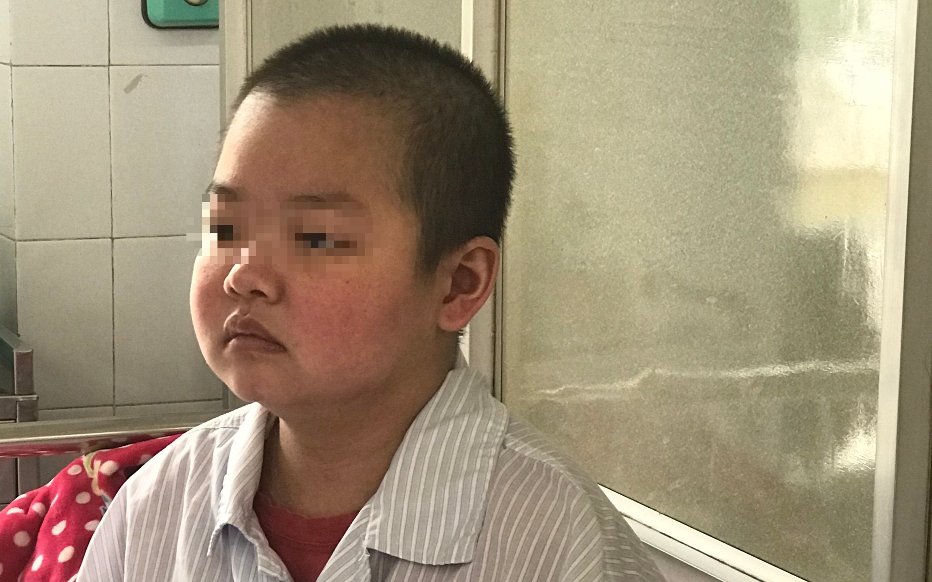 5 lưu ý chăm sóc răng miệng cho người bệnh Lupus ban đỏ- Ảnh 2.