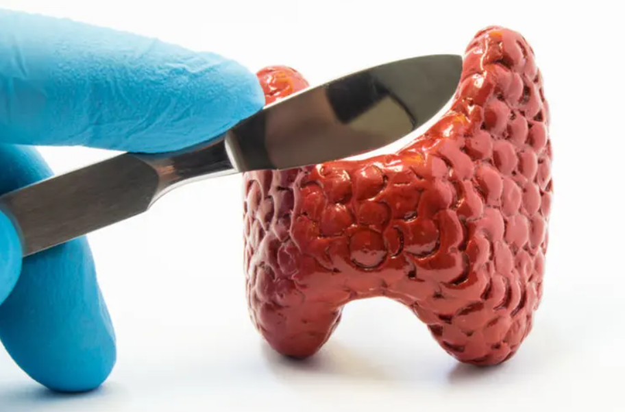 Tìm Hiểu Về Cường Giáp: Những Dấu Hiệu Cảnh Báo Sớm Cần Quan Tâm