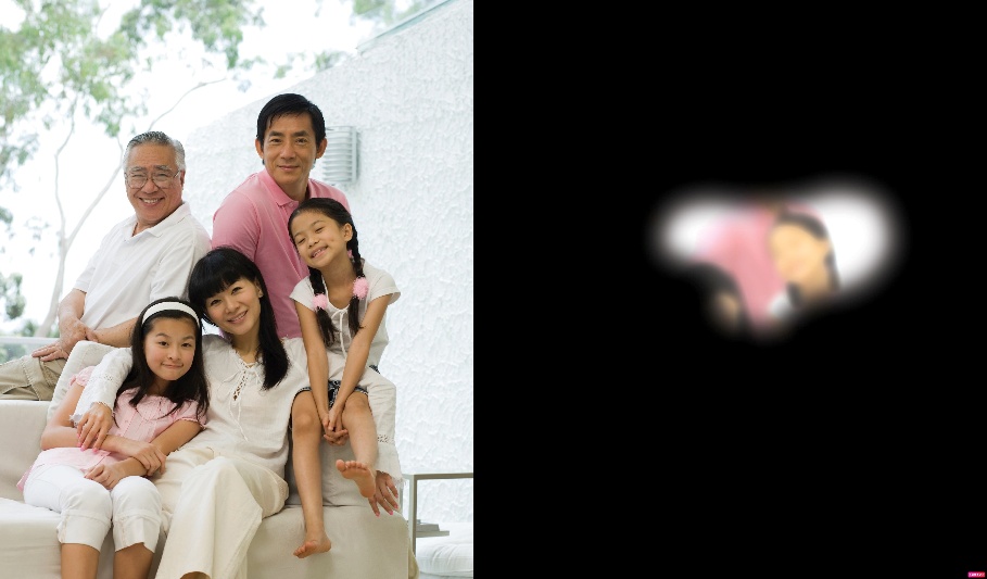 Glaucoma: Hiểu Nguy Cơ và Phương Pháp Điều Trị Hiện Đại Từ Singapore