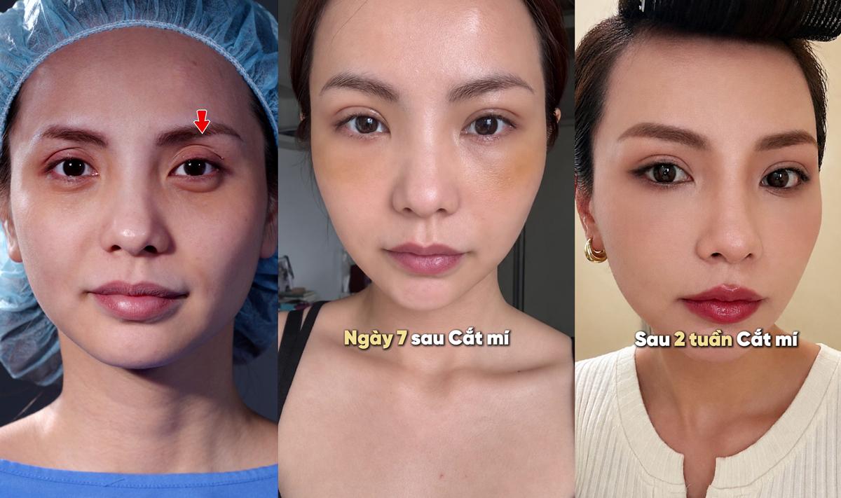 Diễn viên, MC Bùi Linh Chi trẻ hơn sau khi thay đổi một chi tiết trên gương mặt- Ảnh 3.