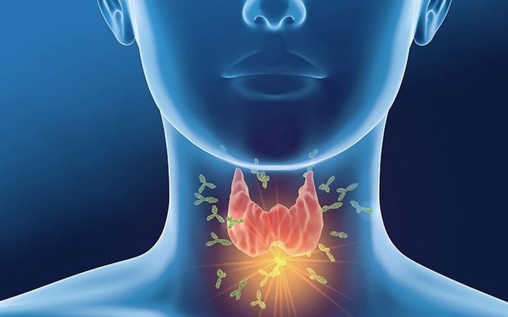 Cách Nhận Biết Sớm Suy Giáp Bẩm Sinh Ở Trẻ Em - Ảnh 1.