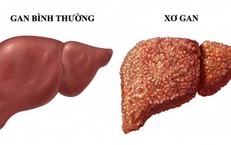 Làm Ca Đêm: Tác Động Đến Sức Khỏe và Giải Pháp Hữu Hiệu