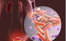 Khô mắt ở người cao tuổi: nguyên nhân, triệu chứng và cách chăm sóc thực tế