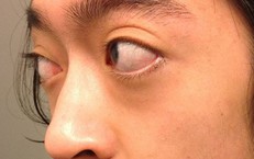 Những Lưu Ý Quan Trọng Khi Sử Dụng Thuốc Cường Dương Cho Người Bệnh Tim
